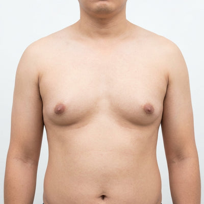 Man Boobs